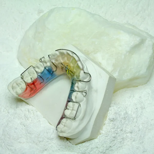 Natura Orthodontics TYPE-3 Siladent